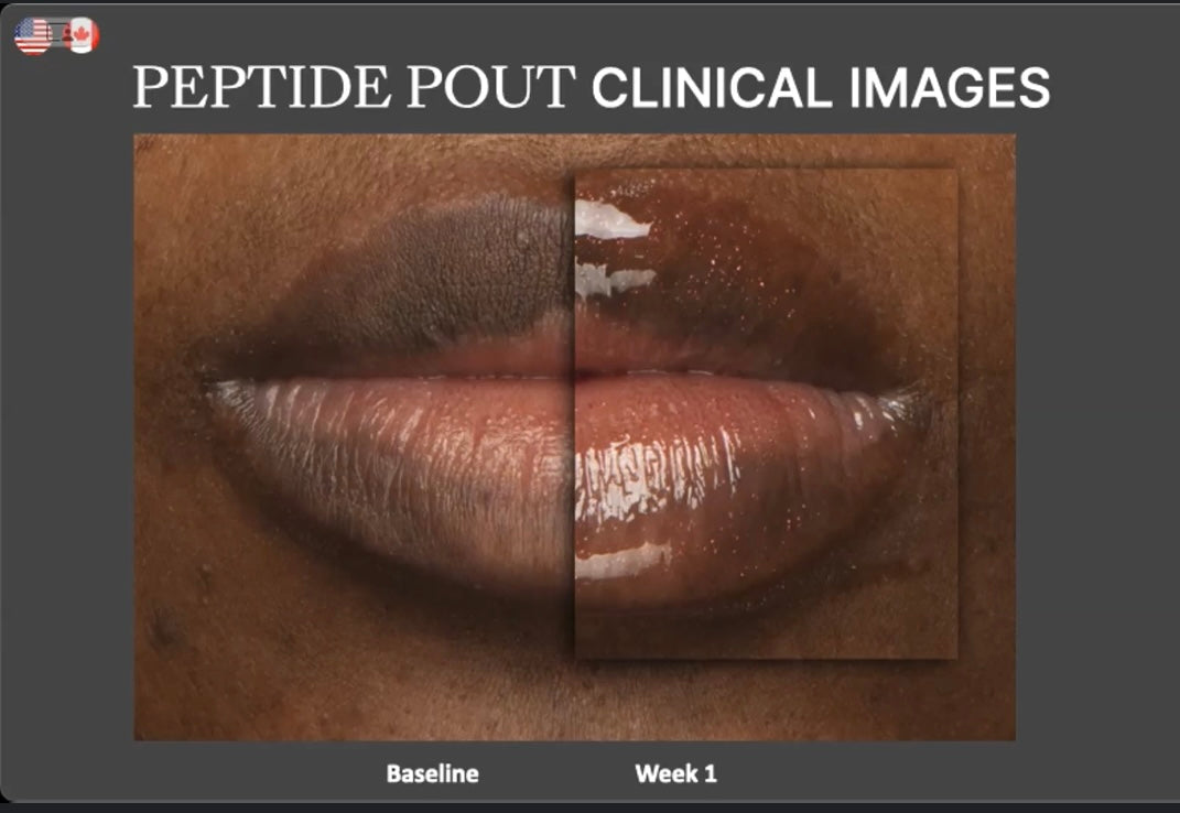 PEPTIDE POUT