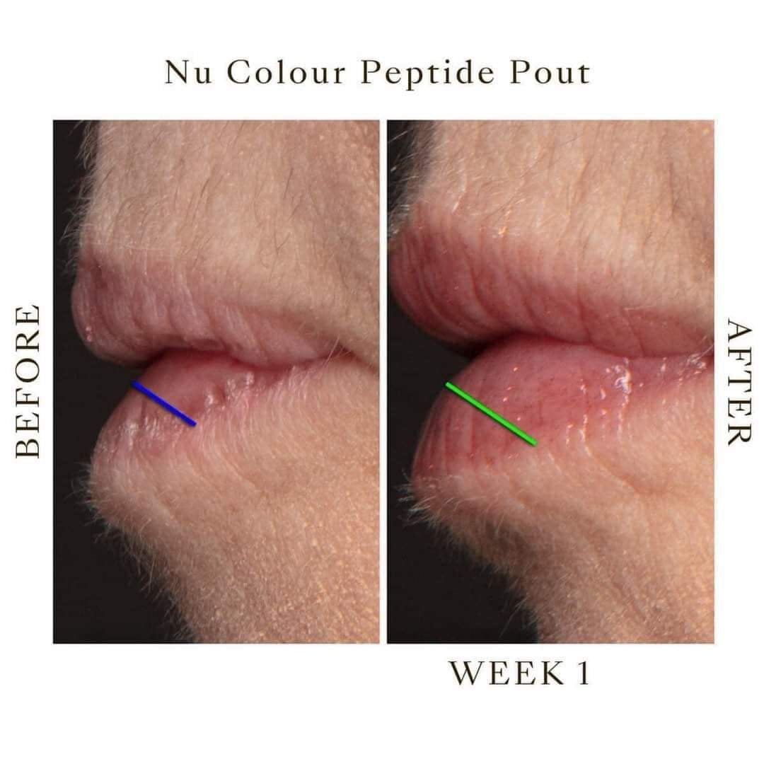 PEPTIDE POUT