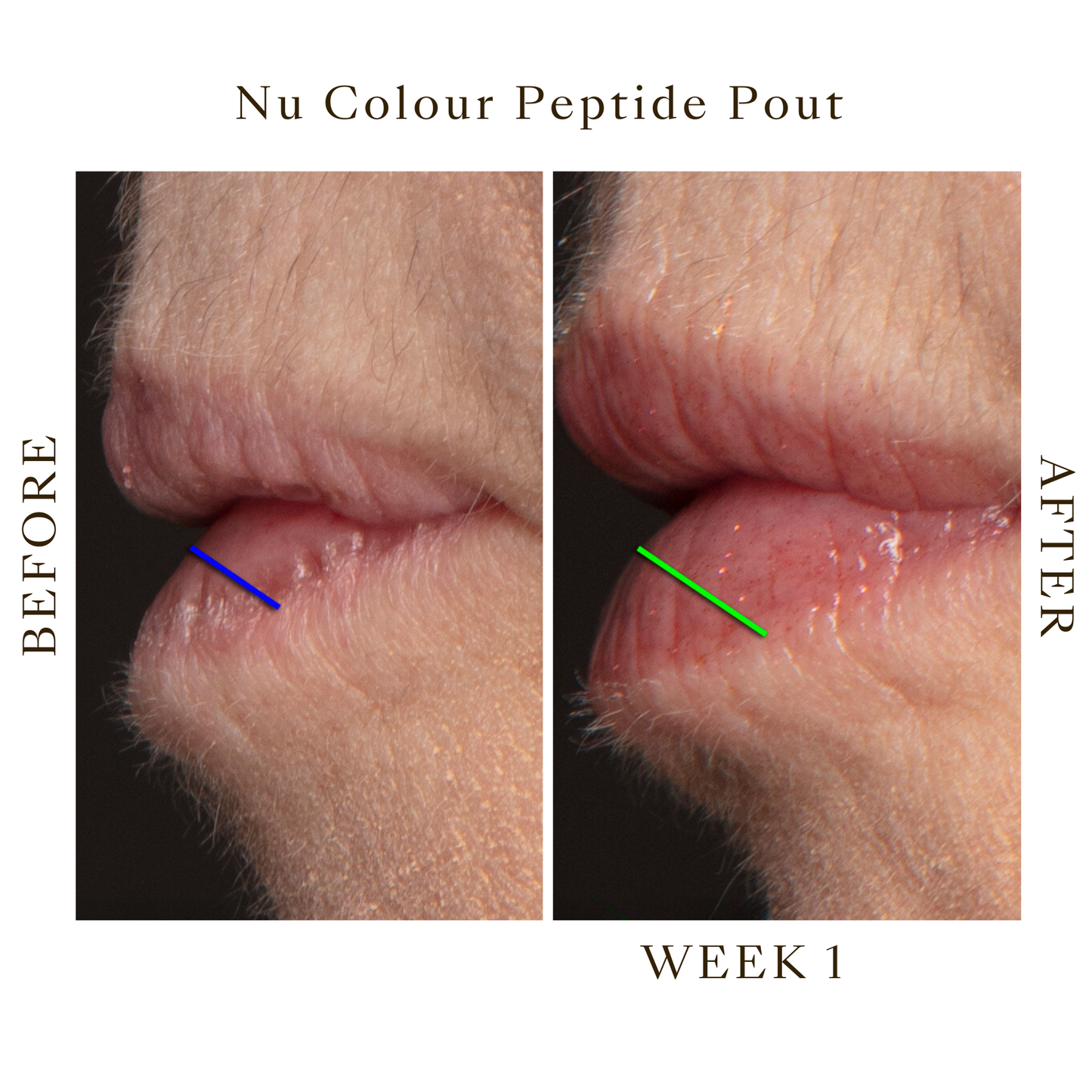 Back to School Sale - Lip Peptide Pout