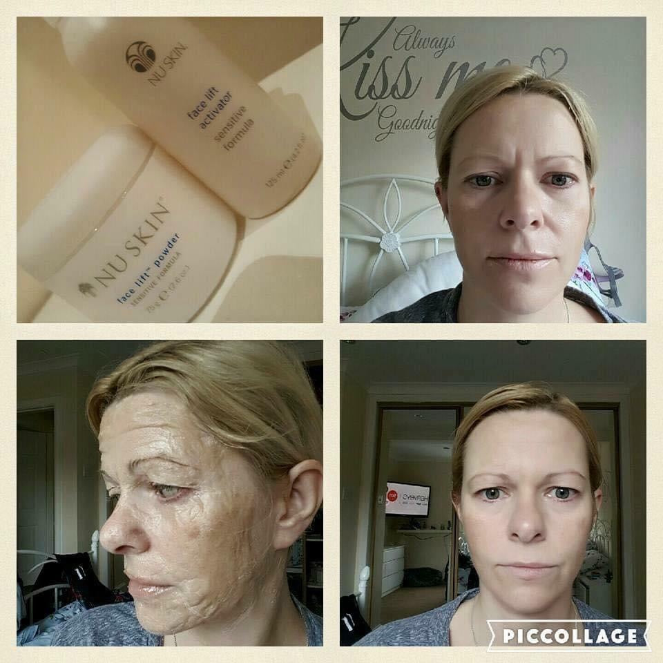 Facelift in a Bottle